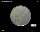 Escherichia coli and salmonella on cled
